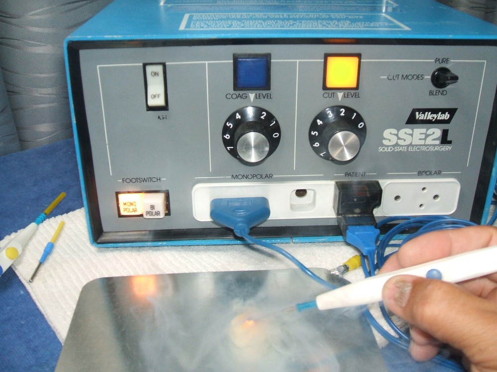 Valleylab SSE2L ESU, Pt. Ready, Nice/Clean/In Great Working Condition, Certified