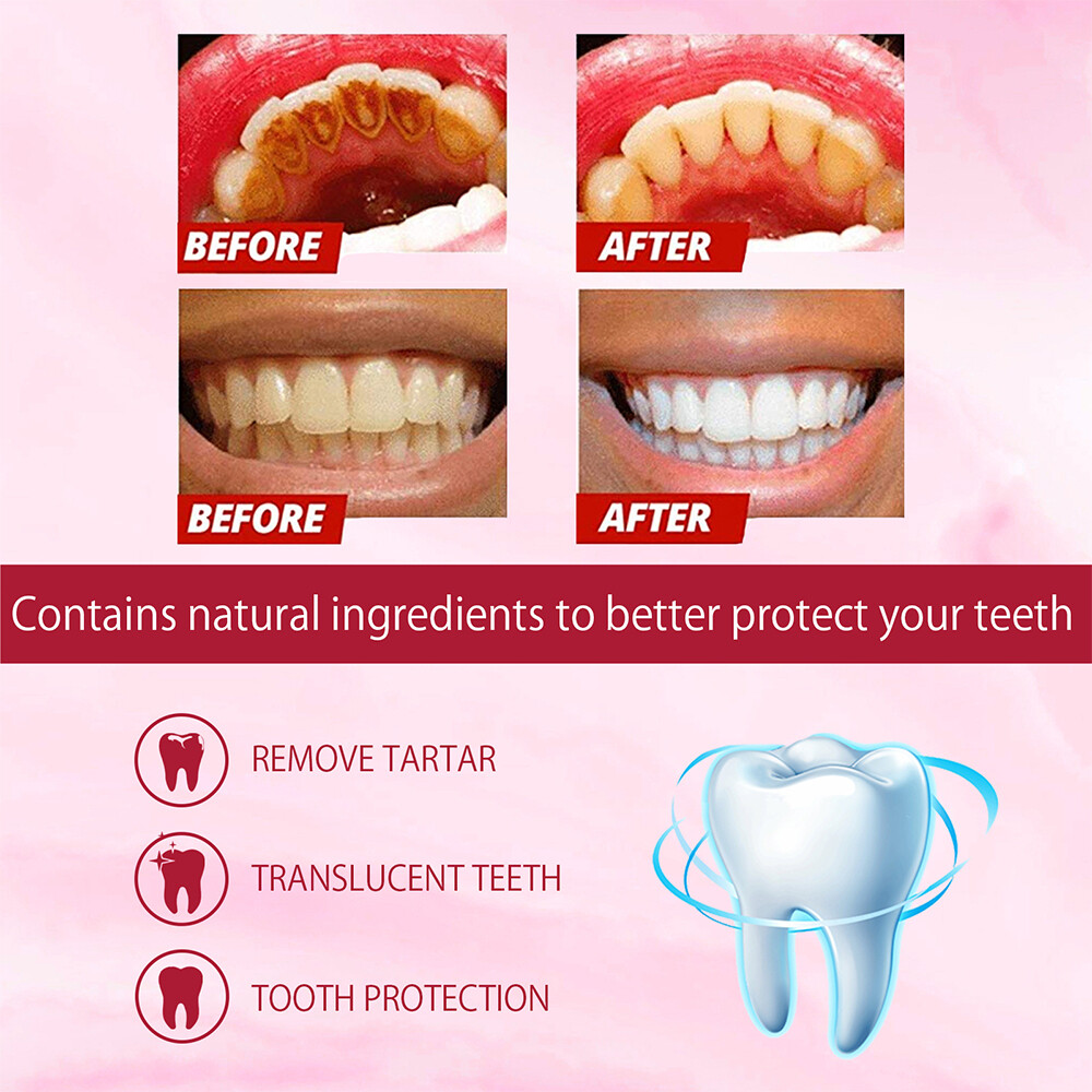 2PCS SP-6 Probiotic Toothpaste,Sp-6 Toothpaste Whitening Quick White Toothpaste