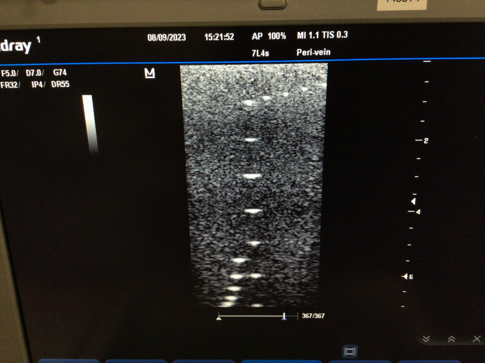 Mindray 7L4s Linear Array Ultrasound Probe