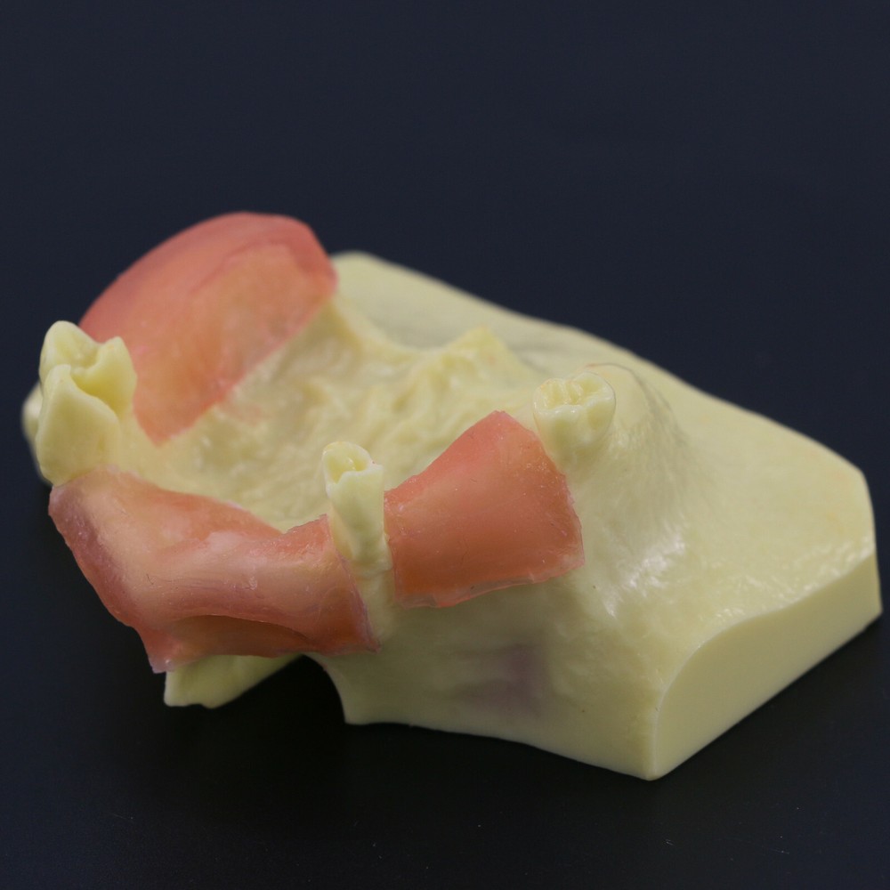 Dental Typodont Teeth Model Sinus Lift Practice Study Teach Demo Model 2012 2013