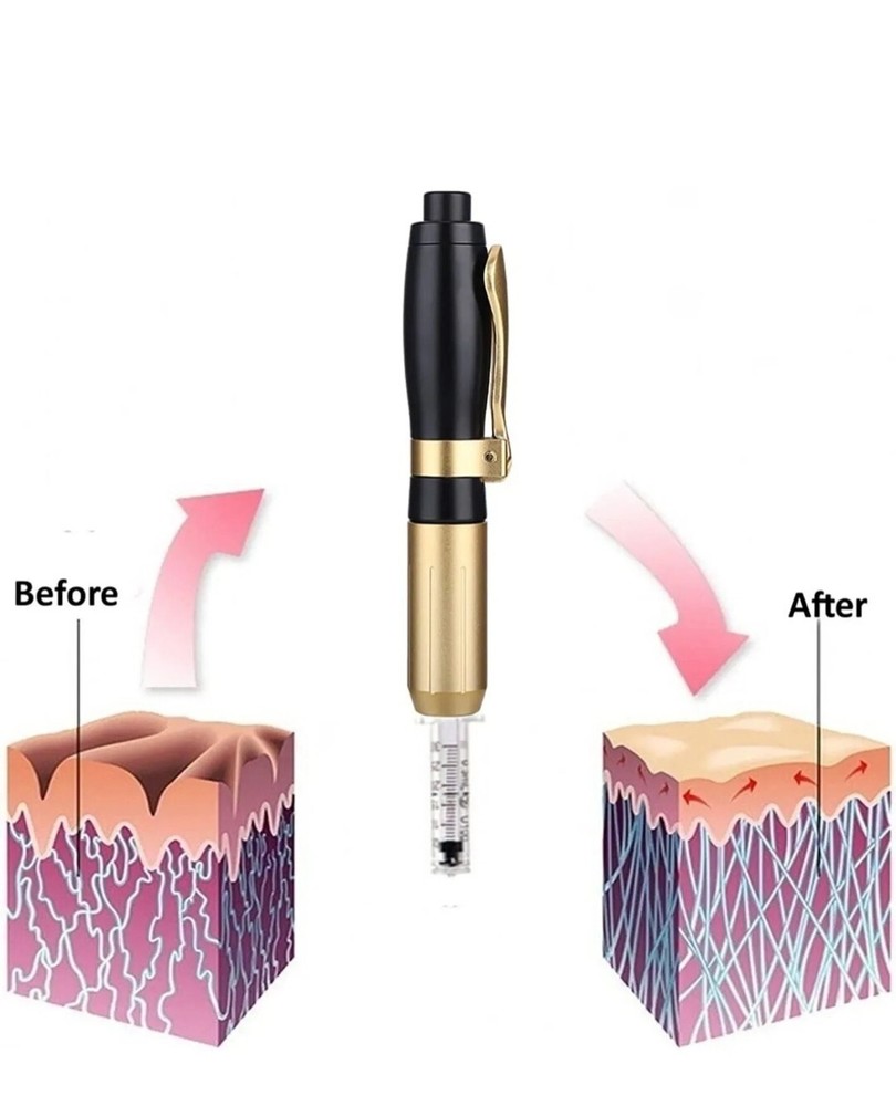 Continuous Mist Gun Needle Free Atomizer