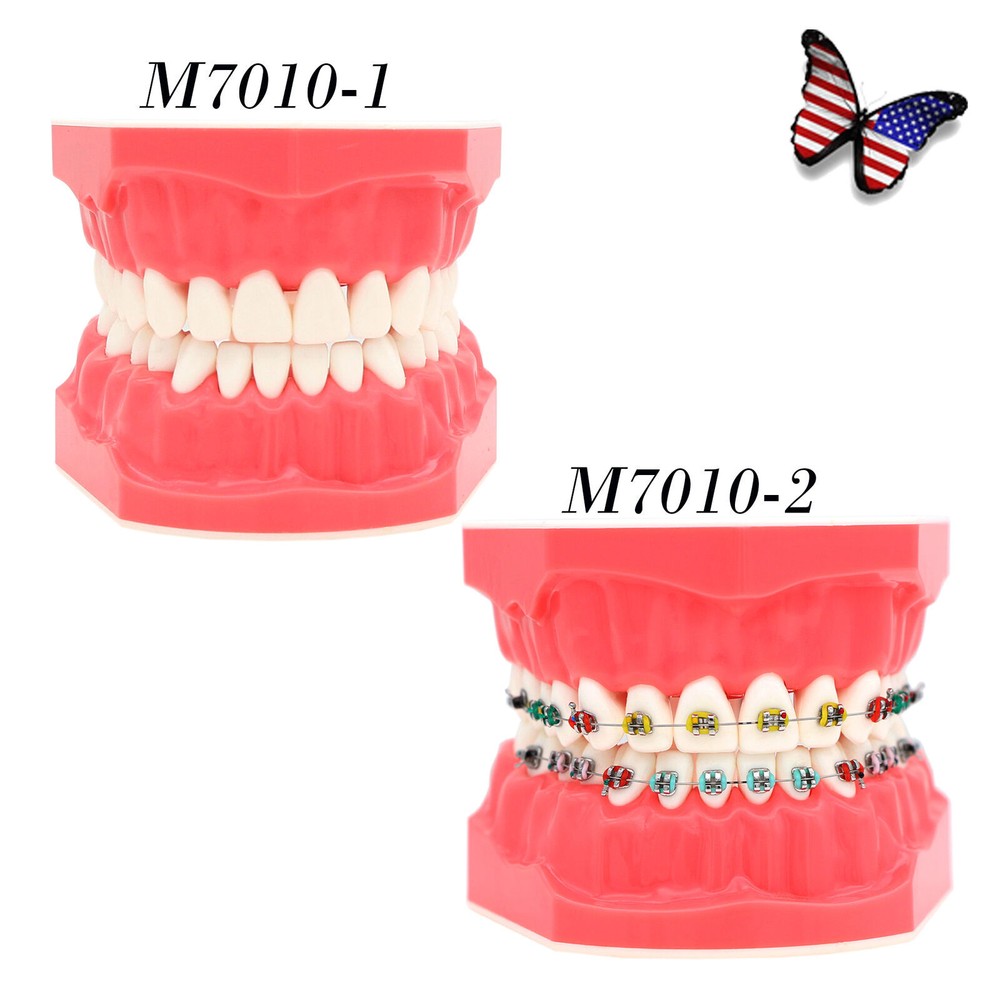 1:1 Dental Teach Study Typodont Teeth Model With Metal Ceramic Brackets Tubes