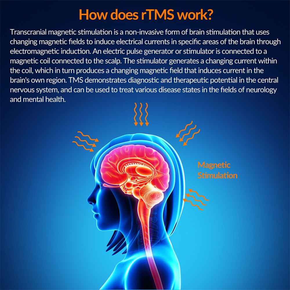Brain Stimulation TMS Device Parkinson Support Motor Function Wellness
