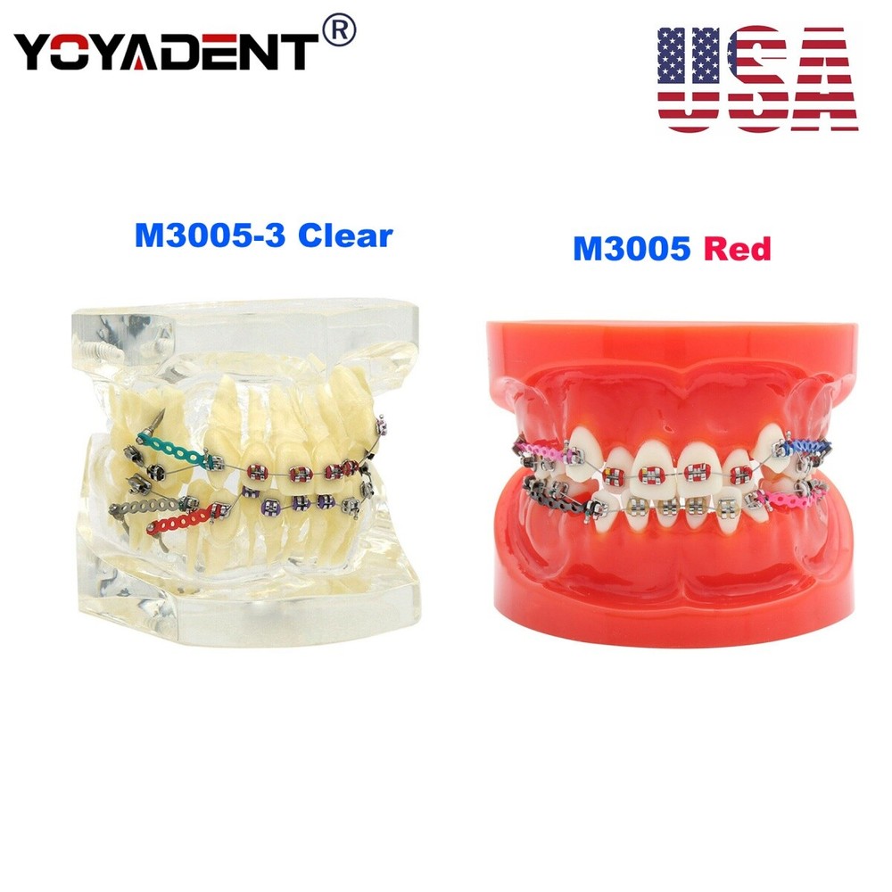 Dental Teeth Teaching Model Orthodontic Model Metal Arch Ceramic Brackets