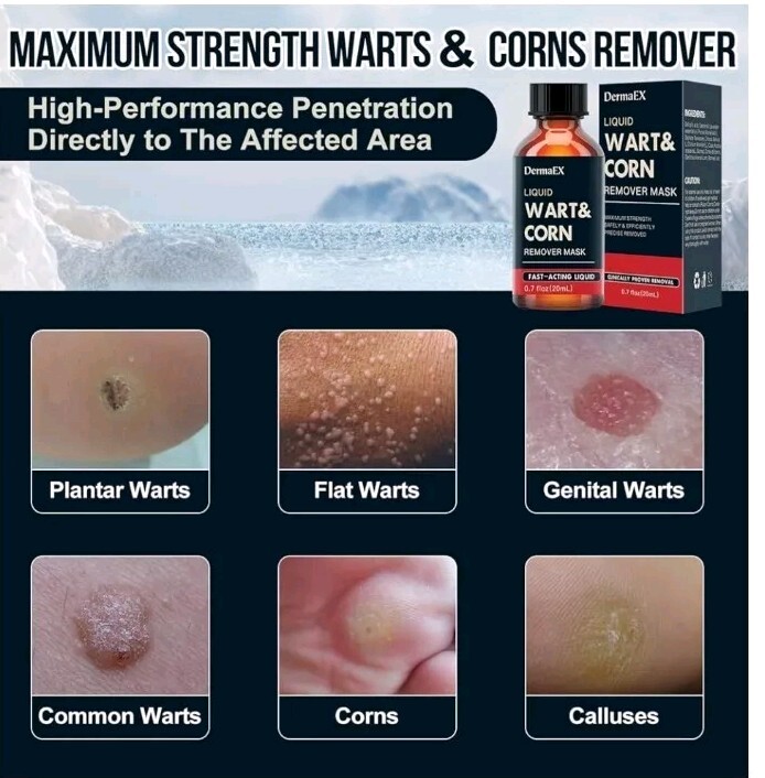 DermaEX Liquid Wart & Corn Remover Mask