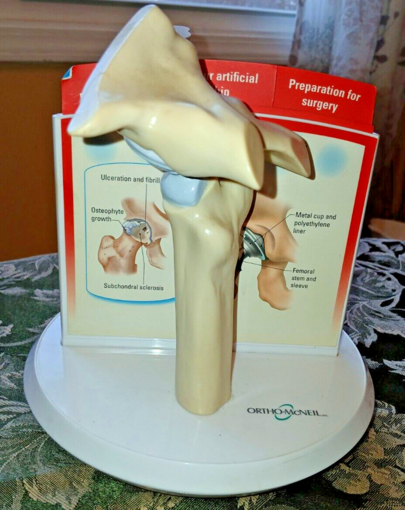 Anatstat ARTIFICIAL HIP JOINT REPLACEMENT Medical Anatomical Skeleton DEMO MODEL