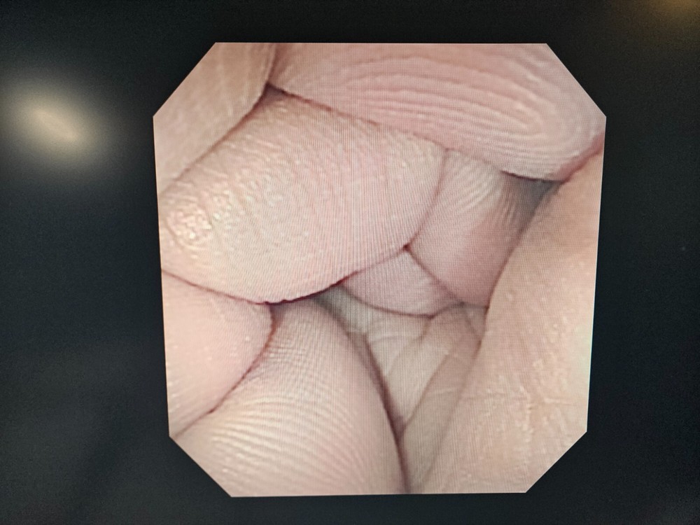 Olympus CF-100S EVIS Video Sigmoidoscope