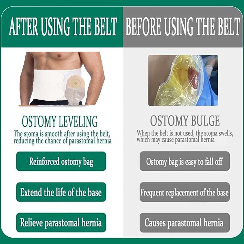 Ostomy Support Beltï¼ŒAdjustable Prevent Parastomal Hernia Support Belt For