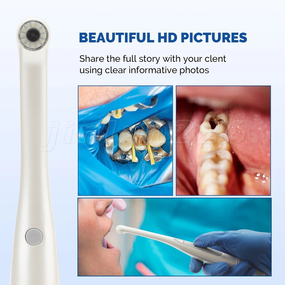 Dental Intraoral Camera & Cable, Excellent