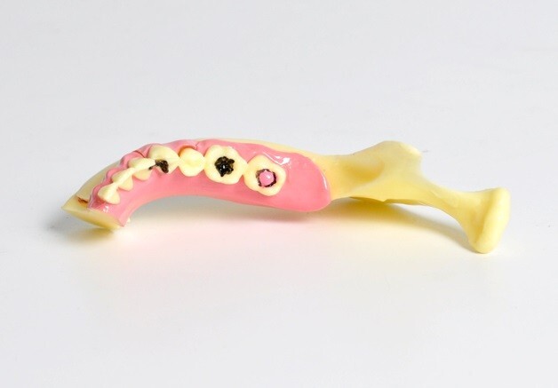 Dental Mandibular Tissue Teeth Anatomical Model Patient Teach Study Model