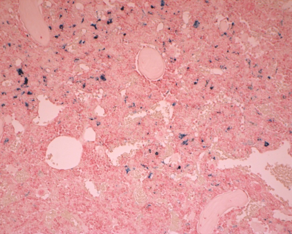 VitroView™ Prussian Blue Stain Kit (Cat# VB-3009)