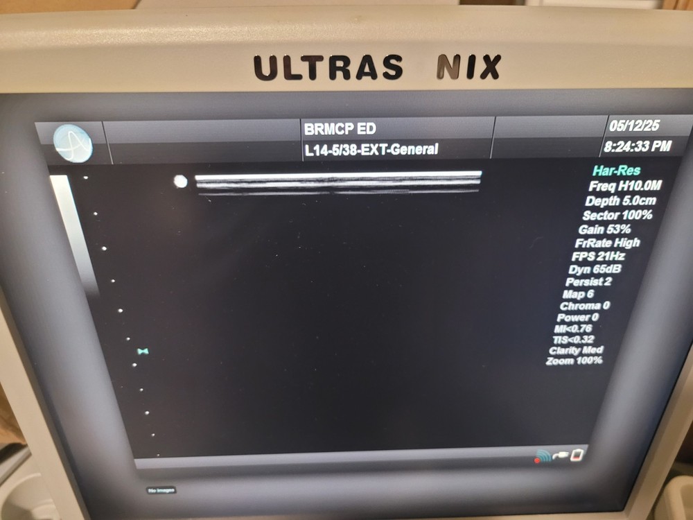 ULTRASONIX L14-5/38 LINEAR ARRAY ULTRASOUND TRANSDUCER PROBE