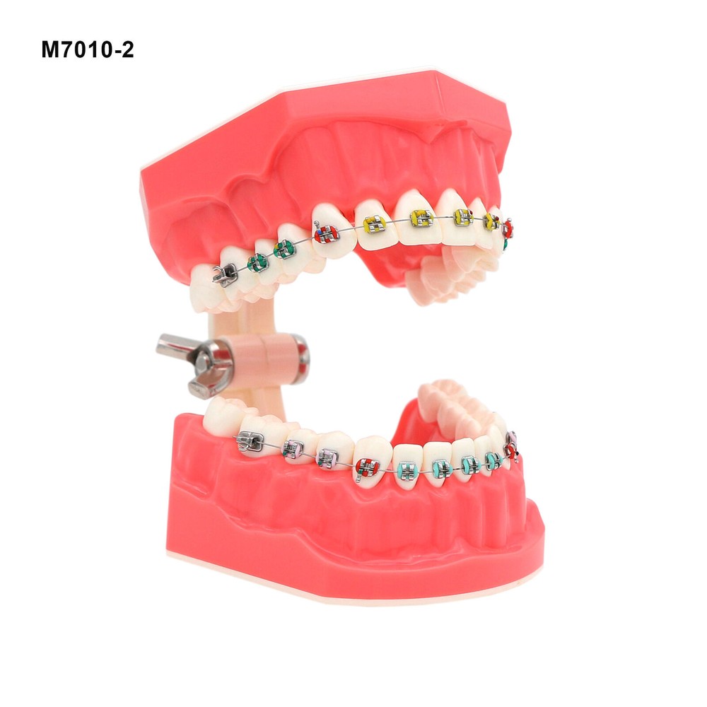 1:1 Dental Teach Study Typodont Teeth Model With Metal Ceramic Brackets Tubes