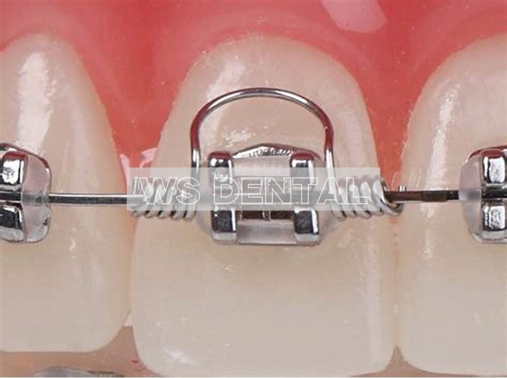 Dental Orthodontic Torquing Torque Spring Rectangular Single Anterior Teeth wire