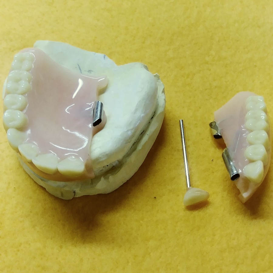 Devided Denture DENTAL DEMONSTRATION TEACHING MODEL Lab Dentist & Oral Surgeon
