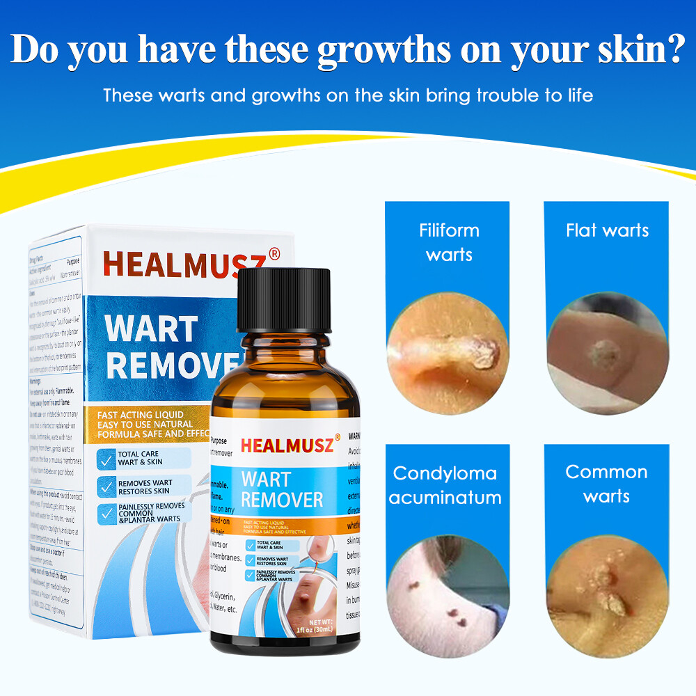 2Pack Wart Remover Liquid Skin Tag Mole Remover Eliminate Feet Corn Wart Remove