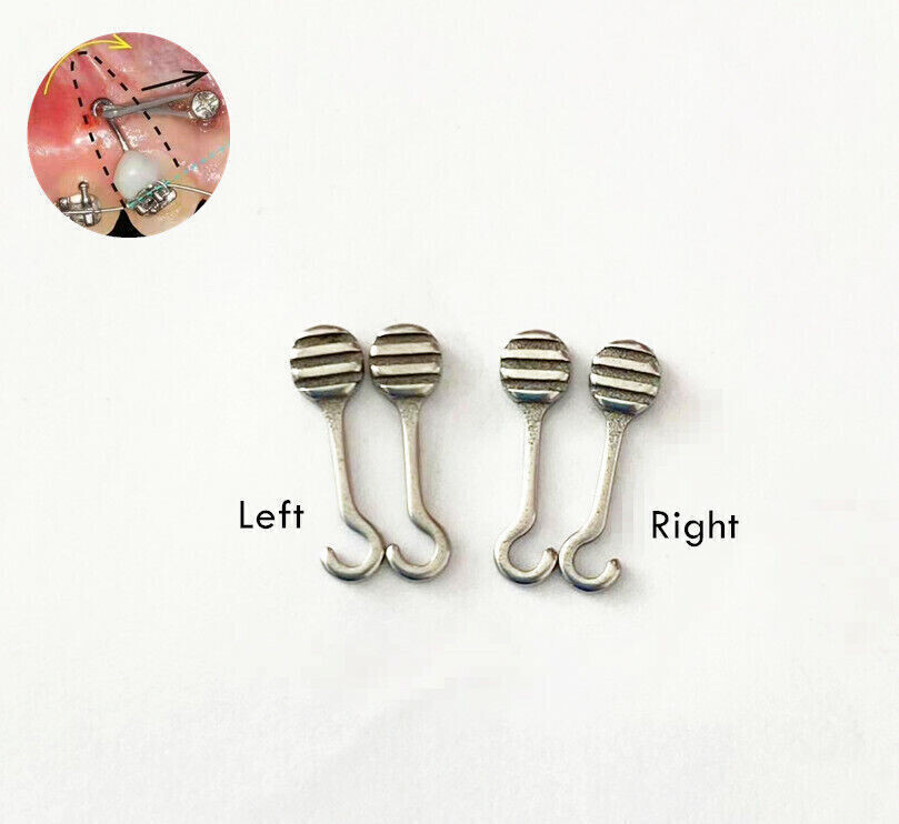 100 Pcs Dental Bonding Crimpable Hook Adhesive Traction Archwire Left/Right