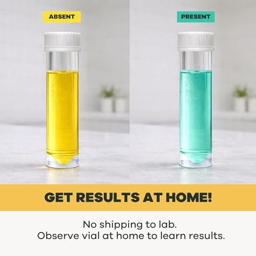 DIY Bacteria Water Test Kit | At-Home Coliform & E. coli Detection | Results