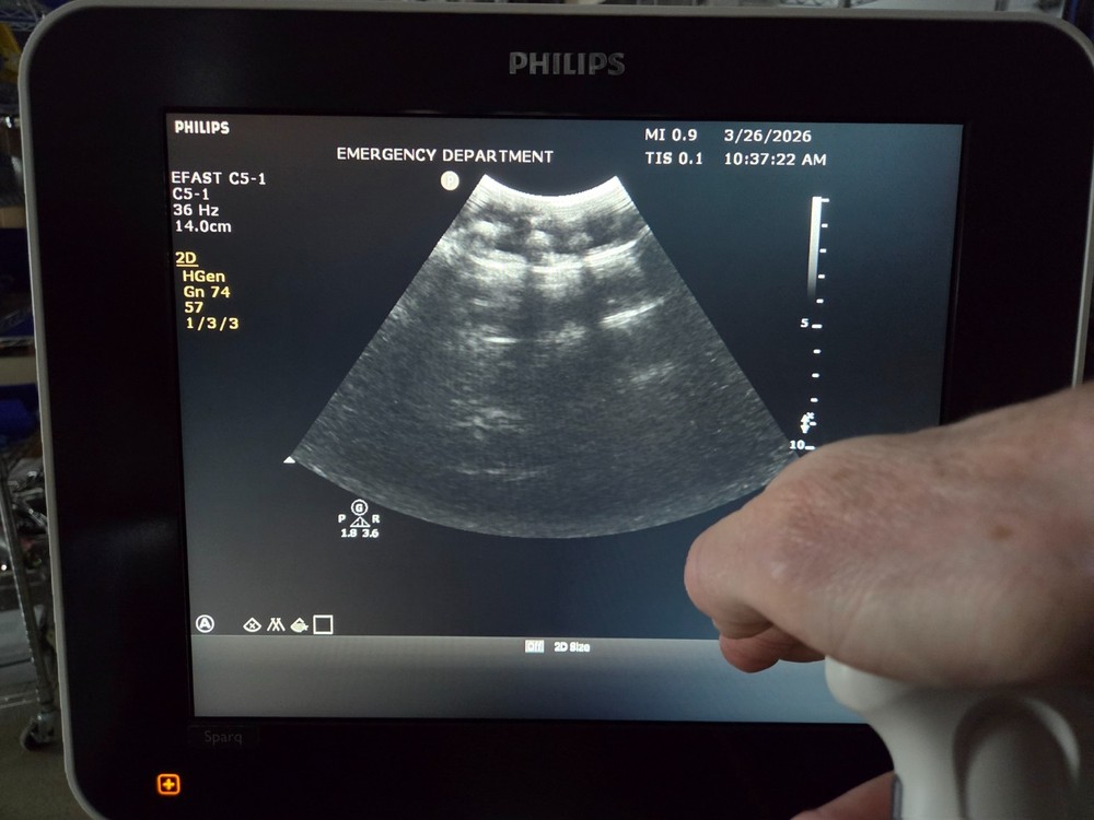 Philips C5-1 Curved Array Transducer - Working - Cord Damage