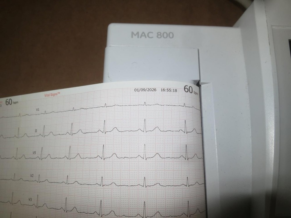 GE MARQUETTE MAC 800 EKG ECG INTERPRATIVE GUARANTEED