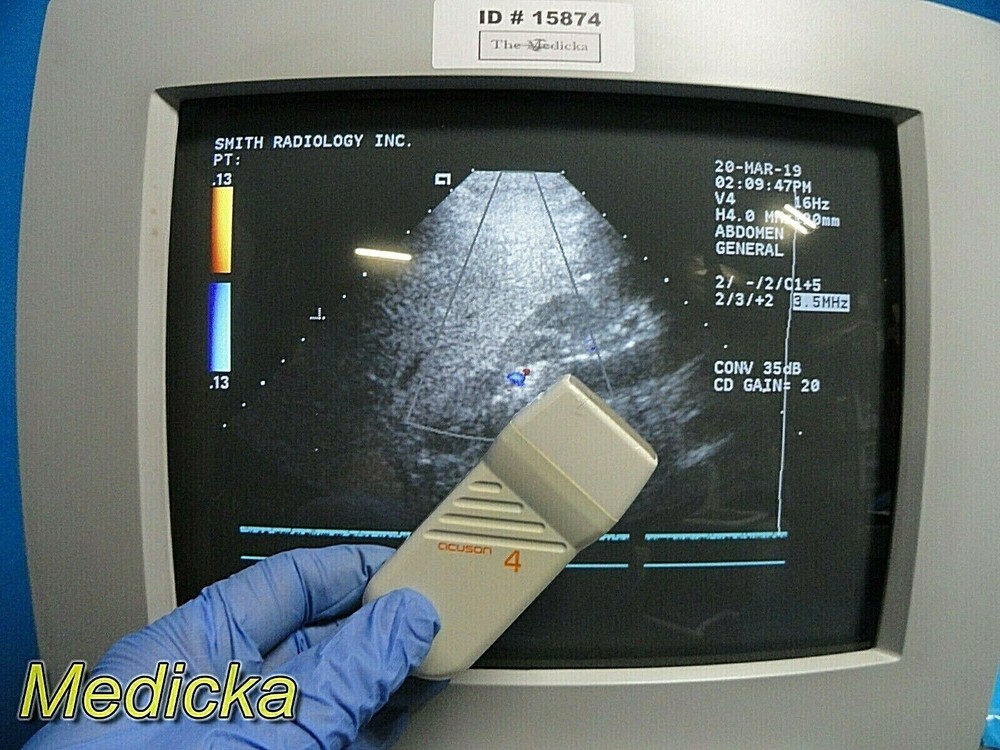 Acuson V4 Vector Array Ultrasound Transducer W/ Pin Connector *TESTED* ~ 17671
