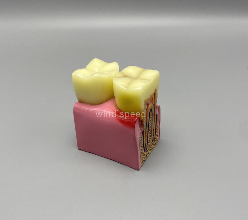 Dental Typodont Teeth Study Teach Model Implant Endo Caries Demonstration