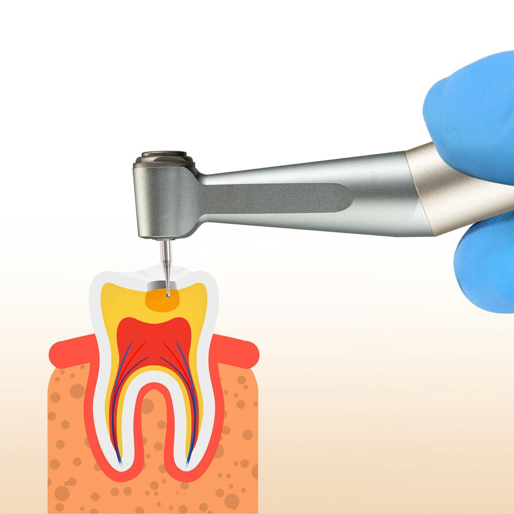 Mobile Dental Machine Unit Digital Imaging System High Frequency/ Sensor S1/S2