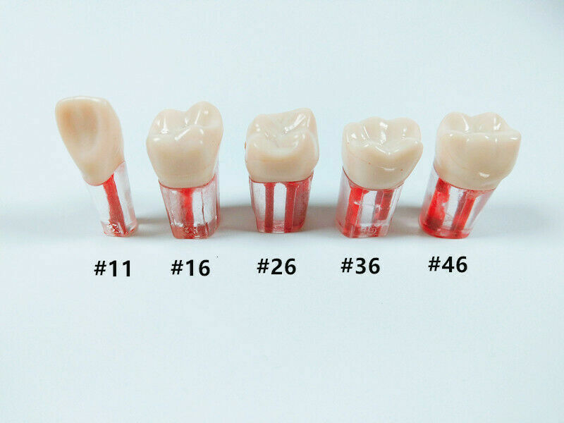 5pcs Dental clear Root Canal Teeth Study Practice Model for Endodontic Pulp File