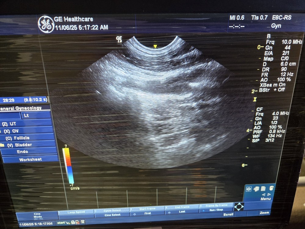 GE E8C-RS Ultrasound Probe / Transducer