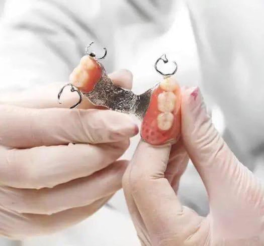 Tooth Repair Kit-Gum Material for Making Temporary Partial or Full Denture,Tooth