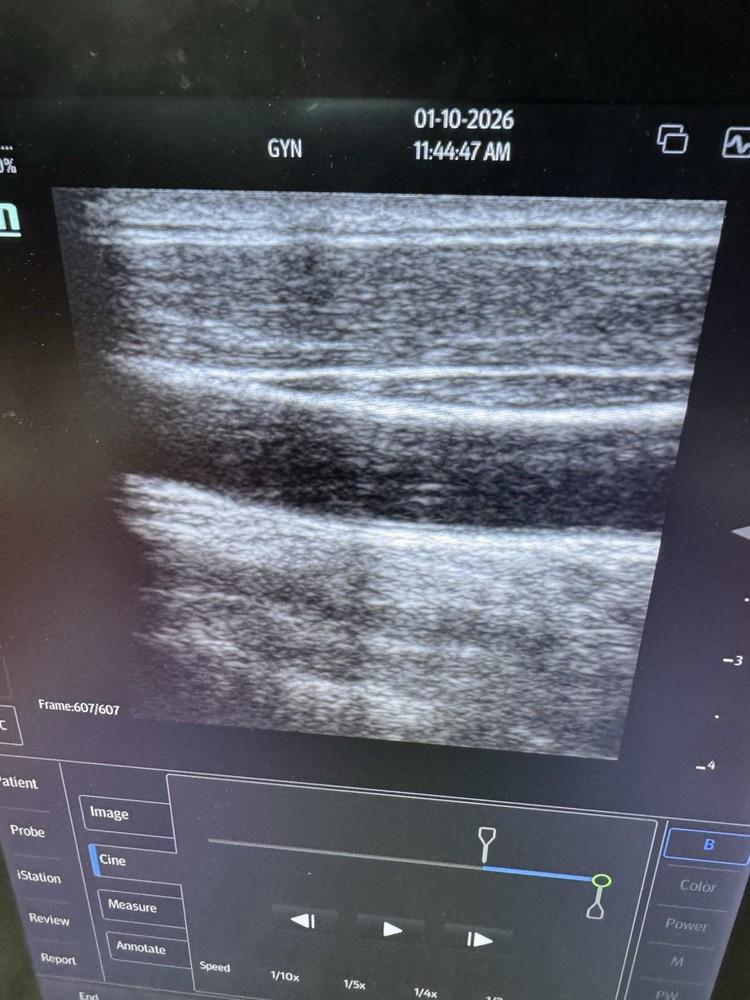Mindray L12-4s Linear Ultrasound Transducer Probe