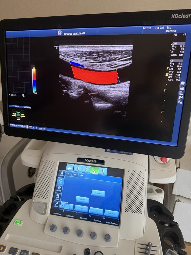 2017 GE 11 L D Probe Excellent working condition