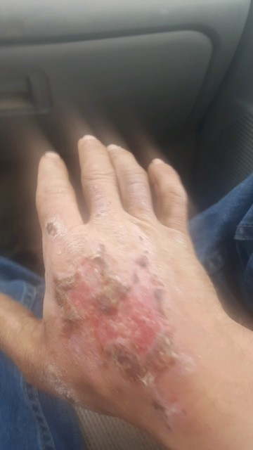 MAGIC V Wound Healing Cream 8oz.
