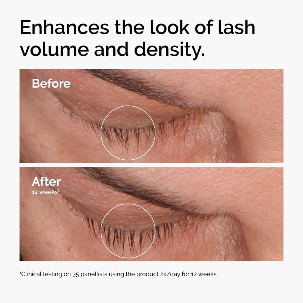 The Ordinary Multi-Peptide Lash & Brow Serum–Thicker Lashes & Brows Authentic