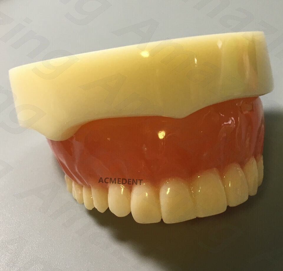 Dental Full Denture Model Overdenture Magnetic Attachment Mandibular Upper Study