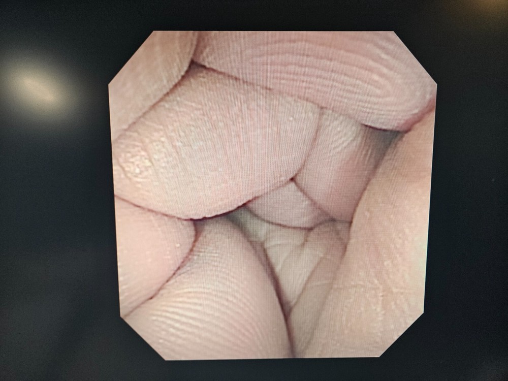 Olympus CF-100S EVIS Video Sigmoidoscope