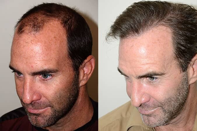 Hair Increase Spell