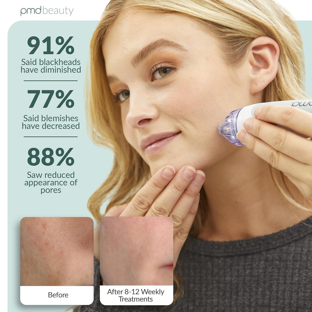$159 PMD Personal Microderm Classic – Clinical-Grade Microdermabrasion (Sealed)