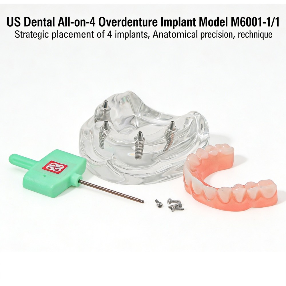 Implant Practice Demo Multiple Types Dental Teaching Teeth Model Typodont Ortho