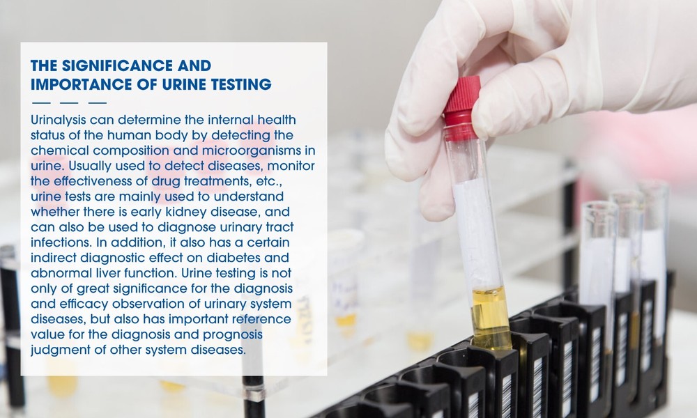 100Pcs Protein Urinalysis 14Parameter Urine PH Test Strips Convenient Quickly