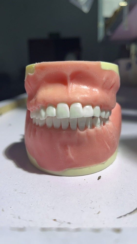 Maxillary+Mandibular Tooth Extraction Practice Model Dental Typodont Display
