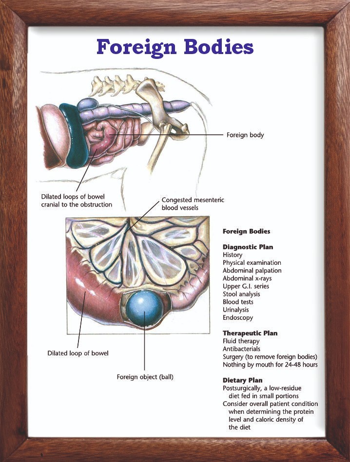 Foreign Bodies Chart 12x18 inches