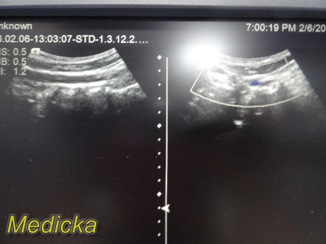 Siemens ACUSON 4C1 Curved Array Ultrasound Probe | Ref 08258525 ~ 39513
