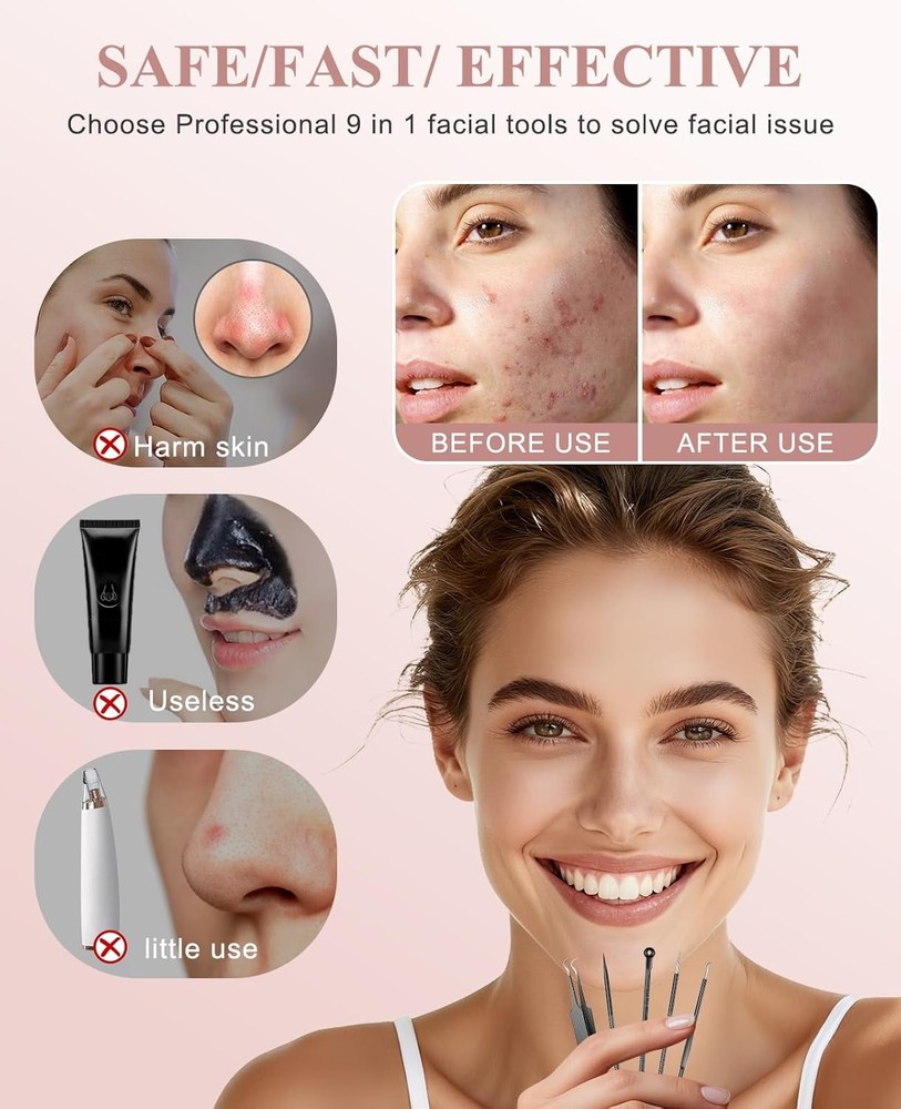 5PCS Blackhead Remover Pimple Popper Tool Kit, Professional use