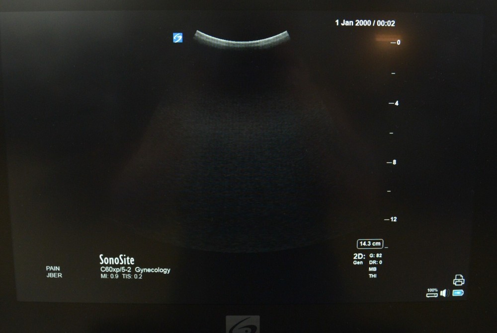 FujiFilm SonoSite X-Porte C60xp/5-2 MHz Curved Array P14561-20
