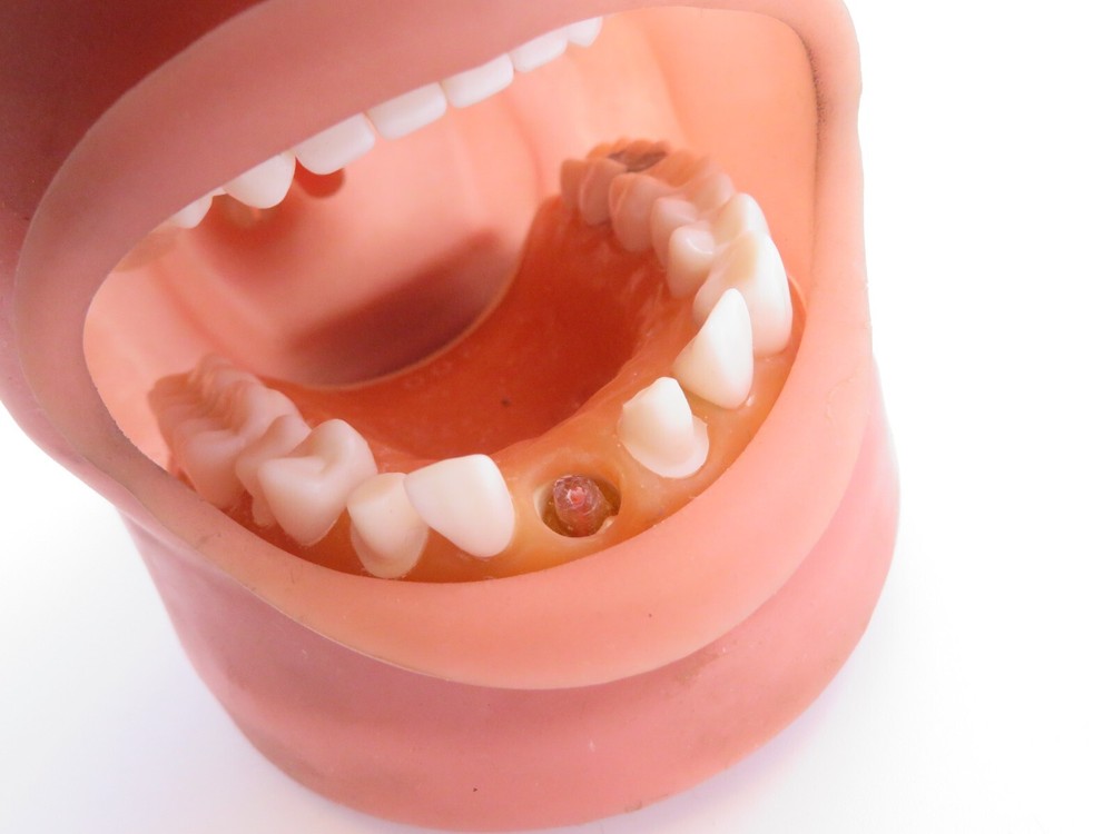 Dental Training Typodont, Dentist Practice Mouth with Teeth