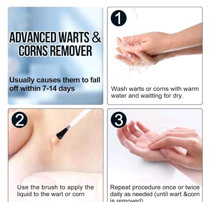 DermaEX Liquid Wart & Corn Remover Mask