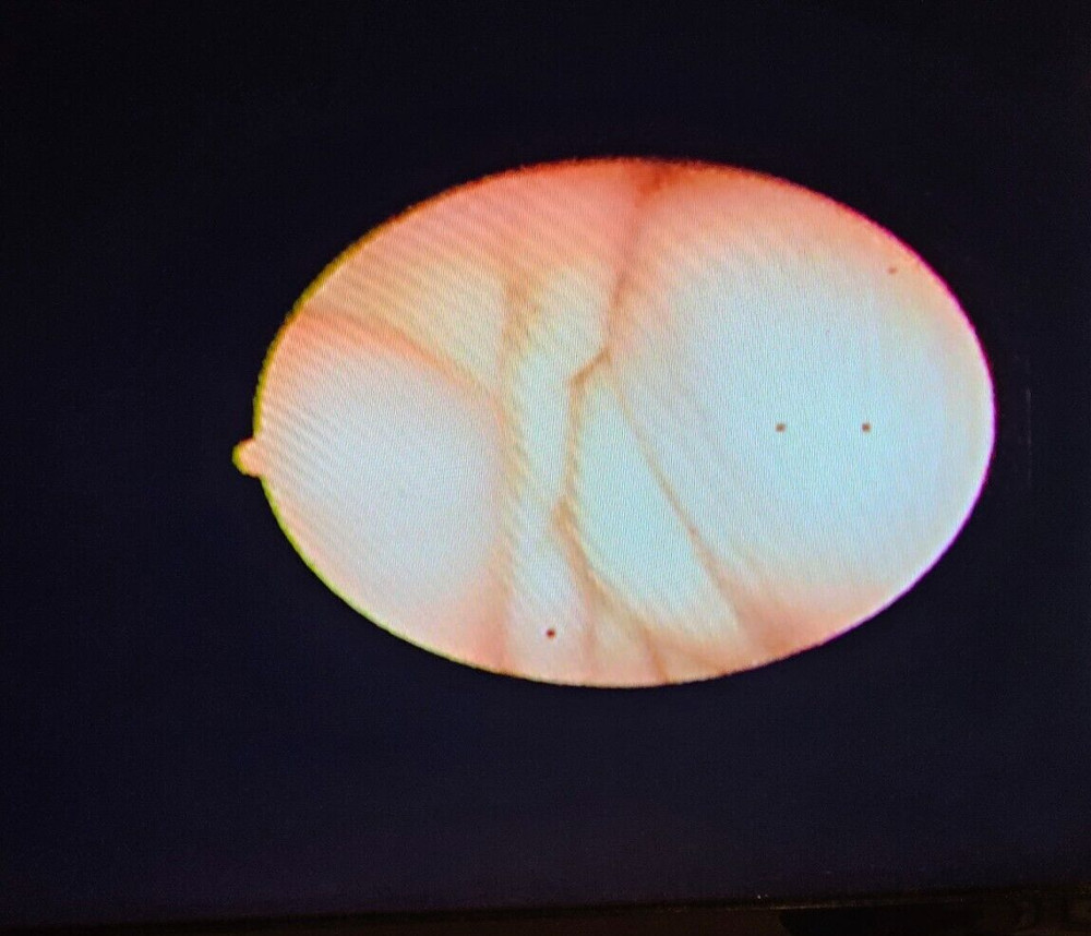 Pentax FNL-10RP3 Endoscope