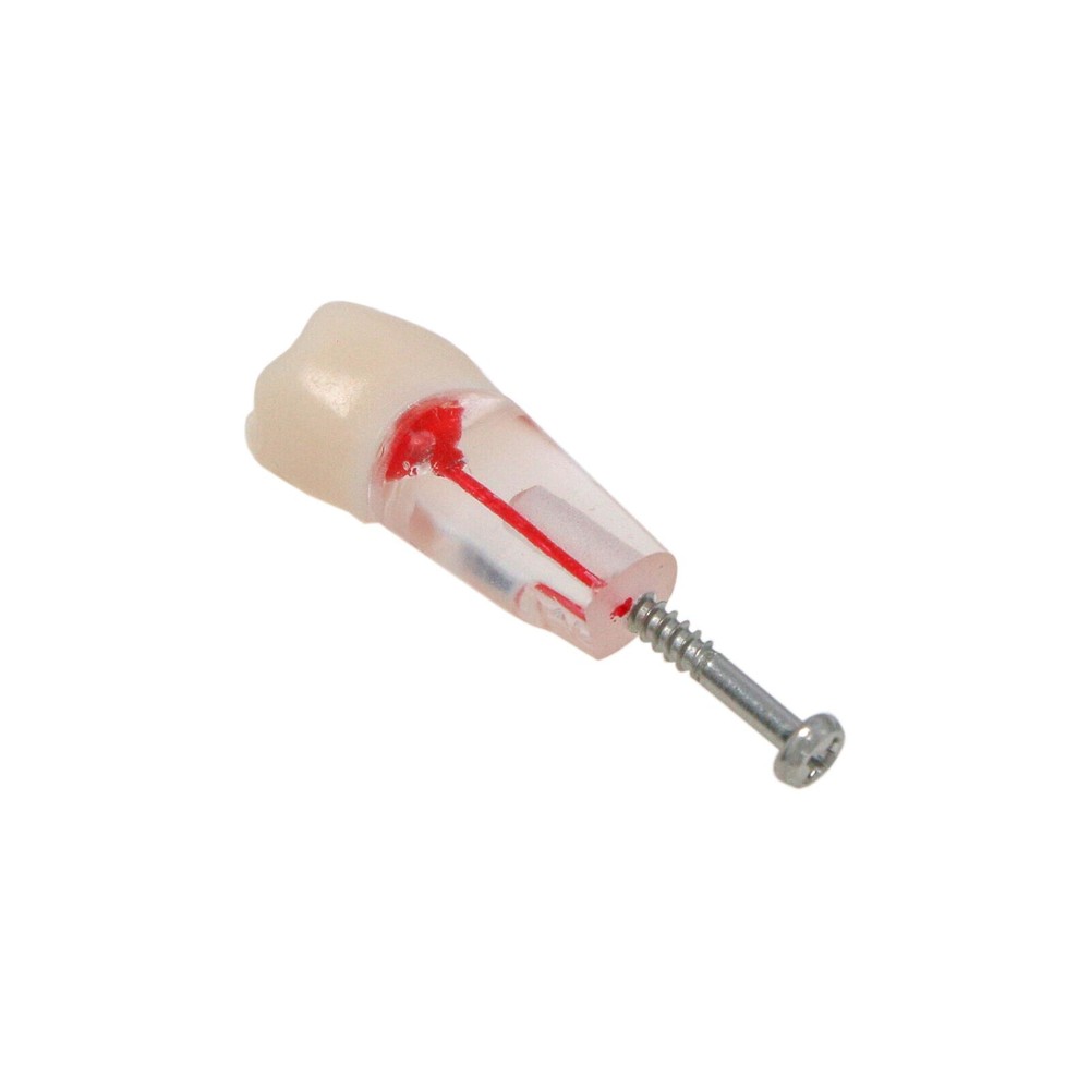 10Pcs/Set Dental Endo Root Canal Teeth Model Study RCT Practice Typodont Model