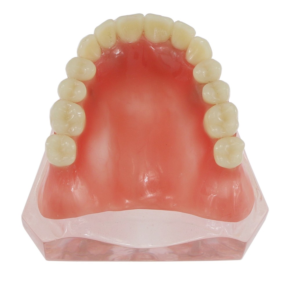 US Dental Implants Teeth Model Upper Lower Jaw 4/6 Overdenture Practice Demo